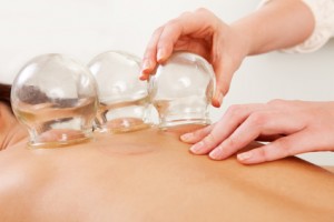 Les ventouses (formation en acupuncture)