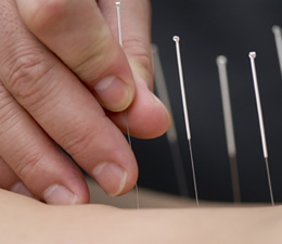 Devenir Acupuncteur