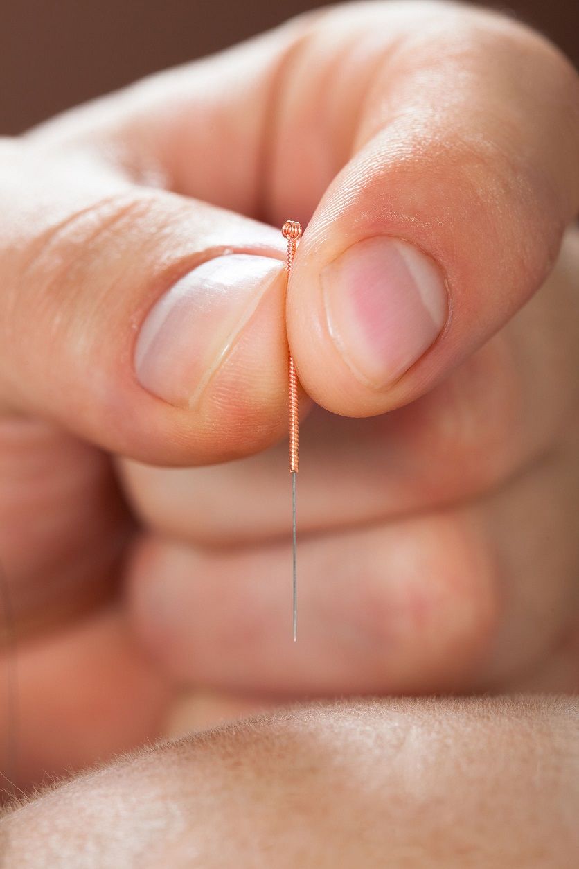 Apprendre l'Acupuncture